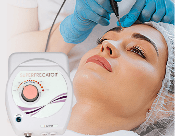 SuperFrecator Generation 3 and treatment