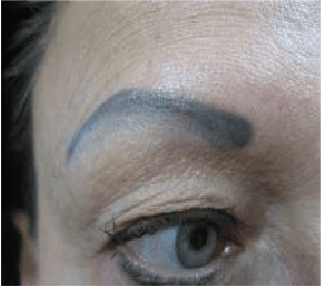 Permanent Makeup