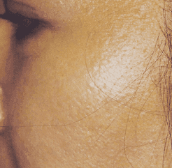 After — case 1