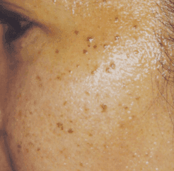 Before — case 1