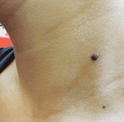 Before — case 2