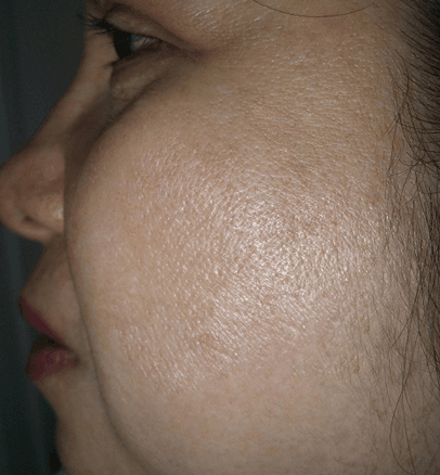 After — case 4
