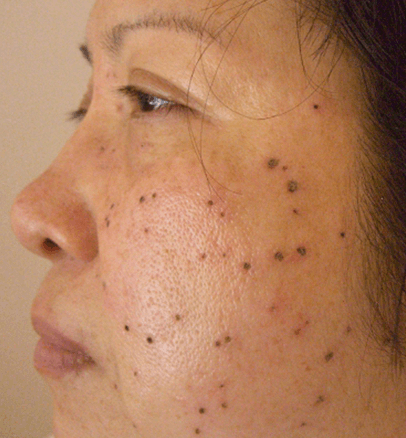 Before — case 4