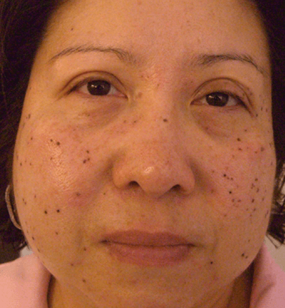 Before — case 5