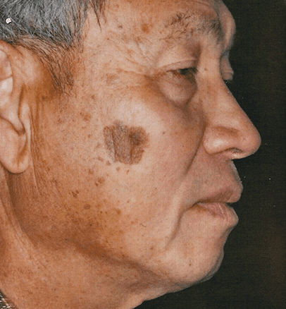 Before — case 6