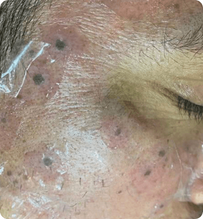 Before — case 8
