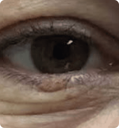 After — case 9