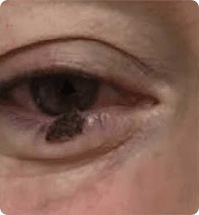 Before — case 9