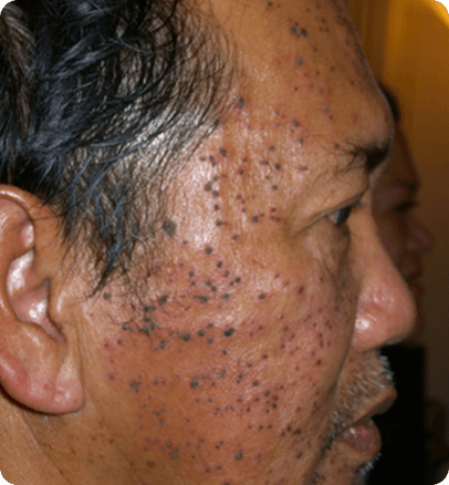 Before — case 10