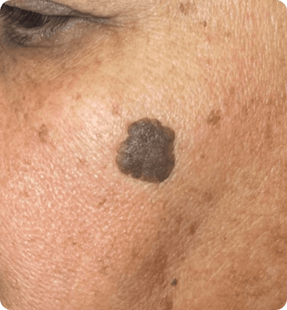 Before — case 11