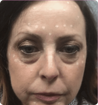Before — case 12