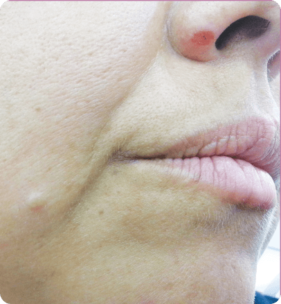 Before — case 15