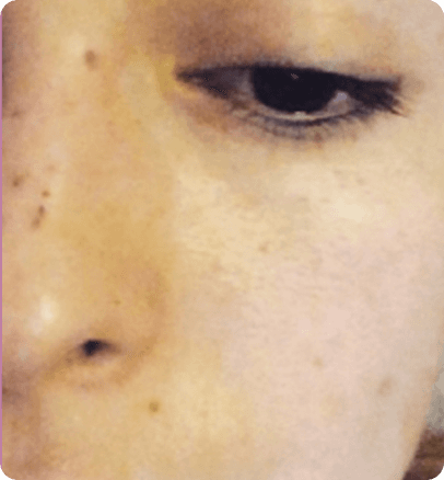 Before — case 16