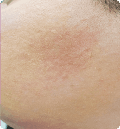 After — case 17