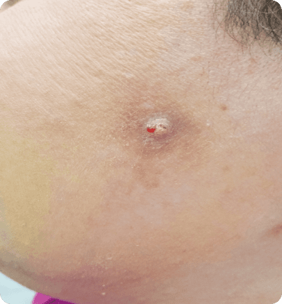 Before — case 17