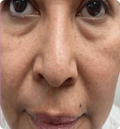 Before — case 18