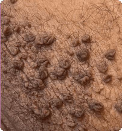 Before — case 19