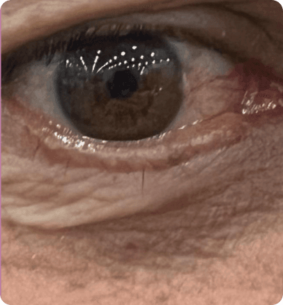 After — case 20