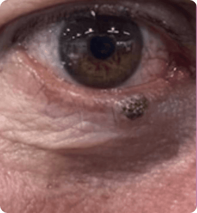 Before — case 20
