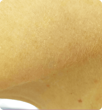 After — case 21