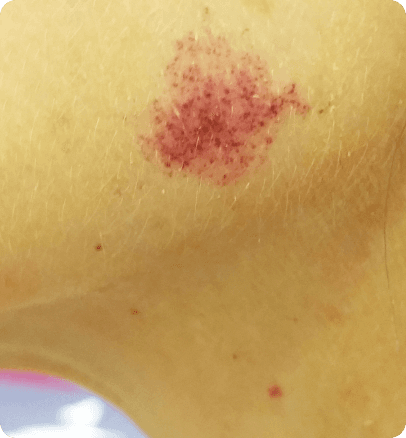 Before — case 21