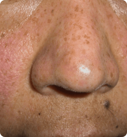 After — case 22