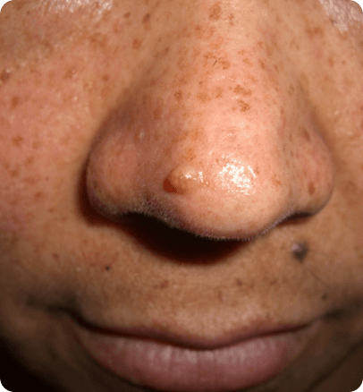 Before — case 22